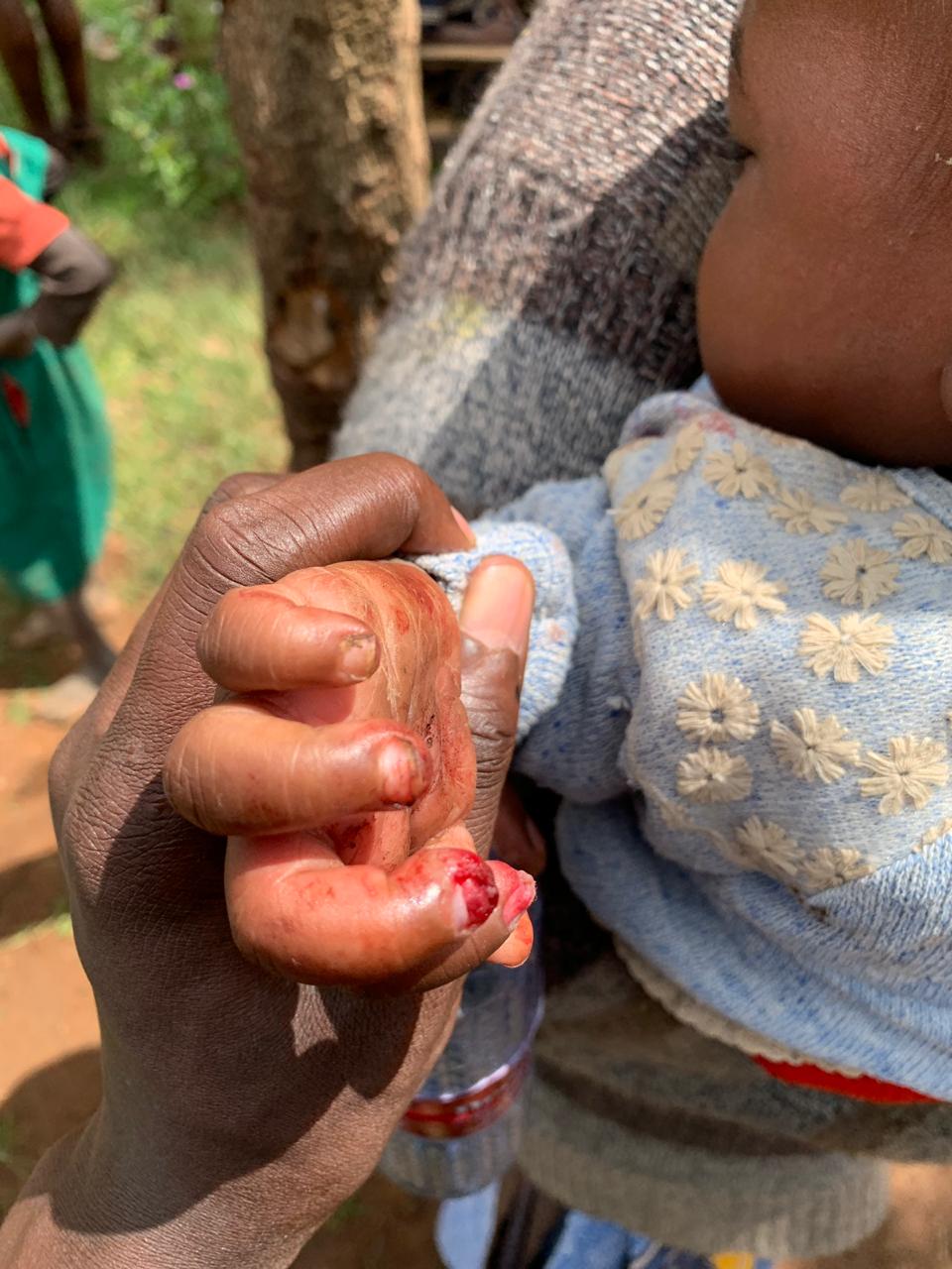 Rays of Care Kenya in the community